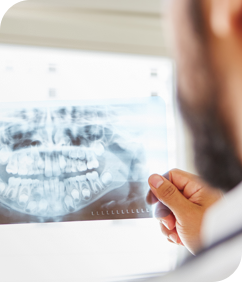 dental implants image dentist Venice Dental